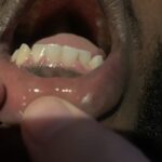 TrueSonic™ Ultraschall-Zahnreiniger photo review